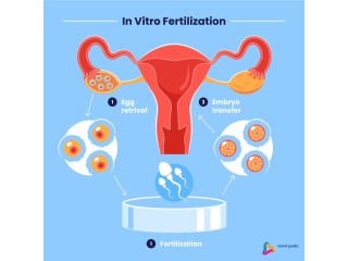 Best IVF Treatment in Mumbai | Dr. Ankita Fertility Center