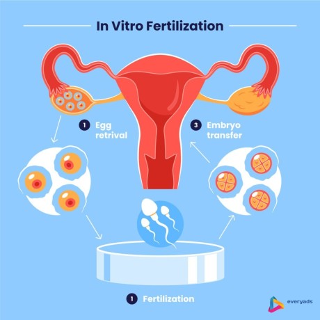 best-ivf-treatment-in-mumbai-dr-ankita-fertility-center-big-0