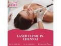 laser-clinic-in-chennai-silkeebeauty-small-0